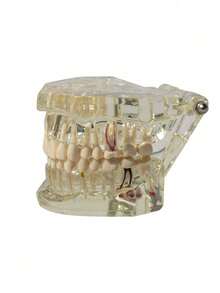 1pc Dental Implant Model, Pathological Tooth Model, Detachable Oral Model, Bridge Demonstration Model For Dental Care - 1PC - View 21