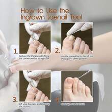 3pcs Silver Ingrown Toenail Removal Kit, Stainless Steel Nail File And Toe Lifter, Professional Pedicure Cleaning Tools For Ingrown Toenail Treatment - Multicolor - View 3