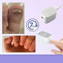Suttik 1/2/4 PCS UV LED Nail Device, Portable Dual Power Battery/ USB, Low Voltage ≤36V, Lithium Battery, Odorless For Thick Pigmented Nails, Suitable For Toenails - 1PCS-white - View 3
