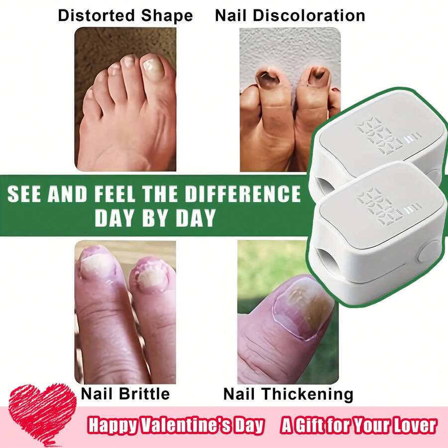 Suttik 1/2/4 PCS UV LED Nail Device, Portable Dual Power Battery/ USB, Low Voltage ≤36V, Lithium Battery, Odorless For Thick Pigmented Nails, Suitable For Toenails