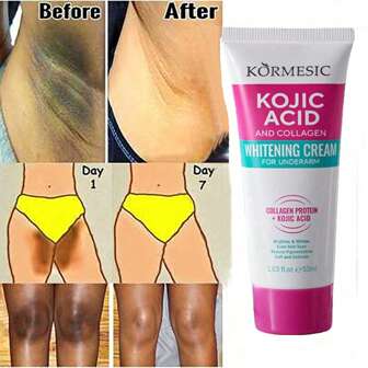 Komeci Collagen Armpit Cream Ondrum Krim Whitening Cream For Daily Use Deep 'body' In The 'set' Body Lotion:1pc