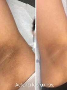 Loción Glycolic Acid 7% Toning The Ordinary Solución tónica normal 7% ácido glicólico normal 240ml emulsión 7% ácido glicólico solución tónica normal exfoliante Tipo de piel Mixta 240mlExfoliante 240 mL Para Todo tipo de Piel de Noche - Toner - Ver 11