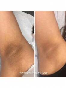 Loción Glycolic Acid 7% Toning The Ordinary Solución tónica normal 7% ácido glicólico normal 240ml emulsión 7% ácido glicólico solución tónica normal exfoliante Tipo de piel Mixta 240mlExfoliante 240 mL Para Todo tipo de Piel de Noche - Toner - Ver 3