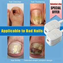 Suttik 1/2/4 PCS UV LED Nail Device, Portable Dual Power Battery/ USB, Low Voltage ≤36V, Lithium Battery, Odorless For Thick Pigmented Nails, Suitable For Toenails - 1PCS-white - View 4