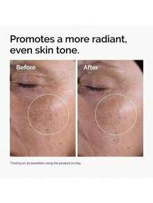 Loción Glycolic Acid 7% Toning The Ordinary Solución tónica normal 7% ácido glicólico normal 240ml emulsión 7% ácido glicólico solución tónica normal exfoliante Tipo de piel Mixta 240mlExfoliante 240 mL Para Todo tipo de Piel de Noche - Toner - Ver 2