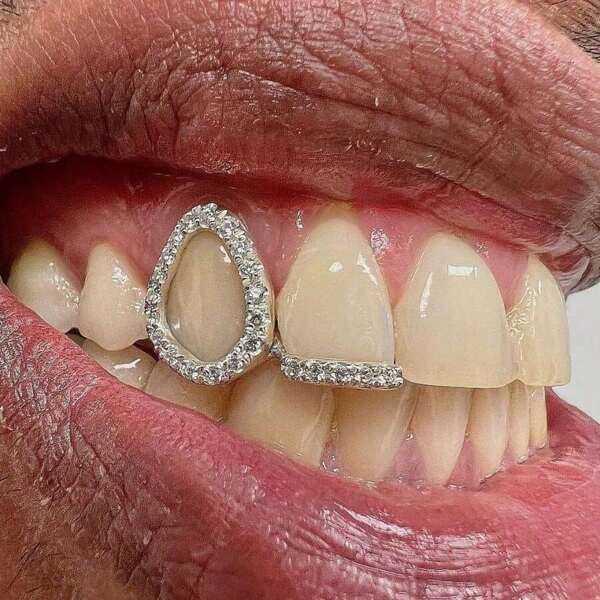 THATBOY 1PC/2PCS/4PCS New Style Hip Hop Teeth Grillz With Star Cubic Zirconia Caps Micro Pave Top & Bottom Charm Grills For Men Women Jewelry