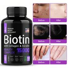 Biotin Capsules - Support Hair Growth, With Vitamin B6 B2 D3, Easy To Absorb, 120 Capsules - 1瓶 - 查看 1