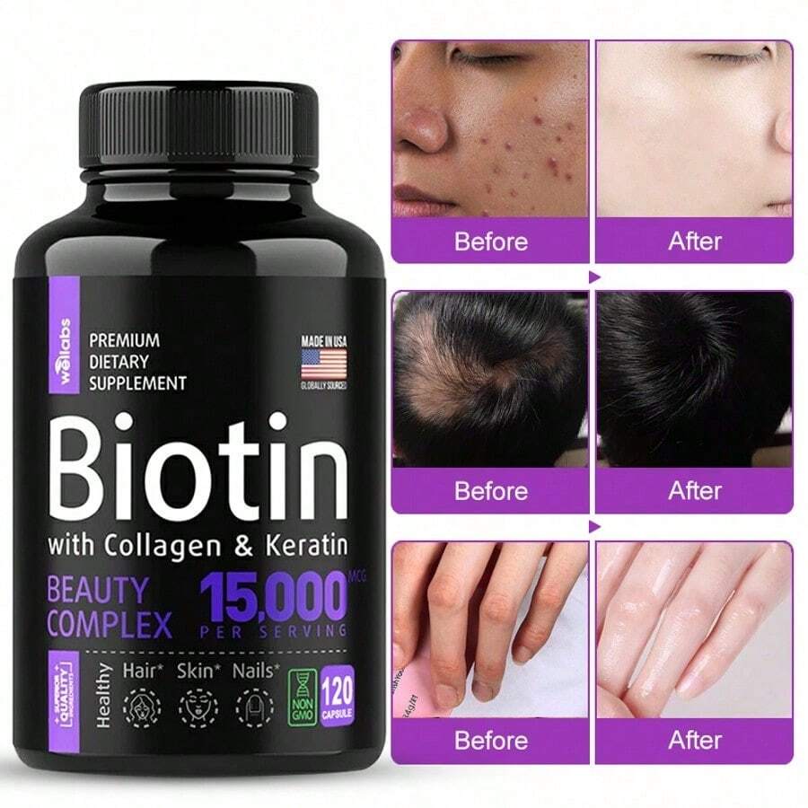 Biotin Capsules - Support Hair Growth, With Vitamin B6 B2 D3, Easy To Absorb, 120 Capsules - 1瓶 - 查看 1