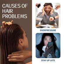 头皮磨砂膏套装 - 滋养控油减少干燥，舒缓头皮压力和不适，提供放松柔软清爽的头皮护理 - 粉色 - 查看 7