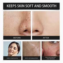 50g，345舒缓霜，日常面部保湿霜，适合：干燥、不均匀、松弛、瑕疵皮肤，使皮肤光滑、柔软、透气 - 乳霜 - 查看 8