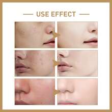 150ml Rice Toner With Glycerin, Panthenol & PCA Sodium – Boost Collagen, Minimize Pores, Fight Acne – Hydrating Exfoliator For Radiant, Glass Skin