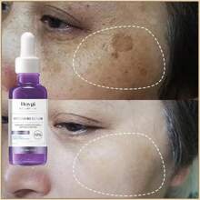 Sérum Clareador B3 com Niacinamida, Glicerina e Ácido Hialurônico - 30ml | Corretivo de Manchas Escuras, Anti-Envelhecimento, Hidrata e Firma a Pele | Reduz Visivelmente as Rugas para um Brilho Jovem