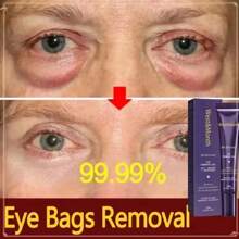 10ml Gel Reafirmante para os Olhos com Cafeína e Retinol | Hidrata, Reduz Rugas, Aumenta o Colágeno | Tratamento Anti-Envelhecimento para Pele Suave Sob os Olhos