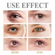 10ml Gel Reafirmante para os Olhos com Cafeína e Retinol | Hidrata, Reduz Rugas, Aumenta o Colágeno | Tratamento Anti-Envelhecimento para Pele Suave Sob os Olhos