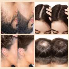GOIPLE 27.5g Hair Fibers + Hairline Powder 4-Piece Set - Fills In Sparse Hair, Instantly Thickens Hair Volume - 5g Hairline Shadow Powder, Waterproof Root Cover Up, Lace Wig Repair Serum, For Filling In Sideburns, Mustache And Eyebrows, With Mirror And Sponge Applicator - Hairline Powder Brush And Fiber Spray Styling Tools - Fiber+Powder 4pcs - 查看 7