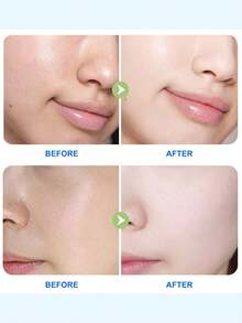 Medicube 零毛孔棉片 温和型 2.0 (70 片) - 温和舒缓面部棉片，蕴含 PHA，可去除角质、收缩毛孔、清除黑头 - 适合所有肤质 - 零毛孔棉片 2.0 - 查看 7