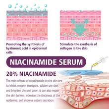 Niacinamide Serum Skin Care Lifting Fade Spots Anti Wrinkle Essence