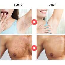 Pain-Free Wax Beans - Long-Lasting Smooth, Suitable For Body, Face, Underarms And Legs - Quick & Easy Homemade Kit - Suitable For Sensitive Skin - Multicolor - View 4