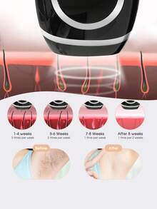 zs 1pc IPL Laser Hair Removal For Women 999,990 Flashes 5 Energy Levels For Permanent Painless Home Use Hair Removal Device Epilator For Bikini Underarms Arms Legs Body - 美規A型插(110-127V) - 查看 4