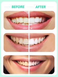 colgate Whitening Baking Soda Toothpaste Bamboo Charcoal Mint Flavor - 3Pcs, Whitening , Gentle And Non-Abrasive, Rich Foam, Breath-Freshening, High Purity - Bamboo Charcoal Mint 3-piece Set - View 2