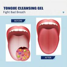3pcs (Random Colors) Tongue Scrapers, Tongue Brushes, And Tongue Cleanser, Helps Fight Bad Breath. This Tool Assists In Eliminating Bacteria That Cause Halitosis - Multicolor - View 5