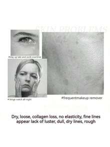 [QINGLIN] Crema antiarrugas y antiedad con ingredientes importados de Francia, hidratante y nutritiva para la primavera, crema humectante y calmante - Blanco - Ver 4