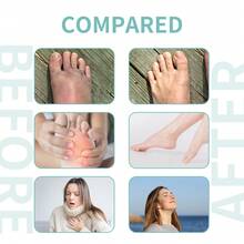 2 piezas Calcetines de masaje de pies + Herramienta de masaje de pies, Juego de masaje de pies, Herramientas de cuidado de pies, Masaje y relajación, Alivio de la fatiga, Kit de terapia de pies - Blanco - Ver 7