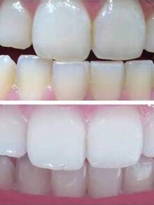 Ap24 Pasta Blanqueadora - Beis - Ver 2