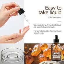 30ml/60ml 乳香精油香薰油，持久留香，设计精美的便携式瓶子，适用于面部保湿、头发、皮肤和身体护理，适用于香薰机、香薰木、家居、户外旅行、汽车，节日的绝佳礼物选择 - 乳香香薰精油 - 查看 4