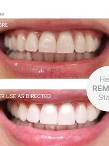 Ap24 Pasta Blanqueadora - Beis - Ver 4