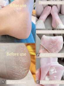 1 Pair Silicone Moisturizing Foot Protector, Elastic Anti-Slip Compression Socks