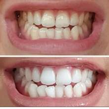 AP 24 Pasta Dental NU SKIN "Sonríe con Confianza: Dientes Más Blancos desde la Primera Semana"  "AP 24: El Secreto Mejor Guardado para una Sonrisa de Impacto"  "Despídete de las Manchas, Hola Sonrisa Radiante"  "Blanquea Sin Dañar: Descubre la Magia de AP 24"  "Tu Nueva Pasta Favorita: Sin Peróxidos, Con Resultados Reales"Sonrisa de Celebridad en 7 Días! Solo con AP 24"  "¡Últimas Unidades! La Pasta que Todos Están Comprando"  "Dientes Más Blancos sin Sensibilidad – ¡Pruébala Hoy!"  "No Es Magia, Es Ciencia: AP 24 Blanqueadora" - Blanco - Ver 5