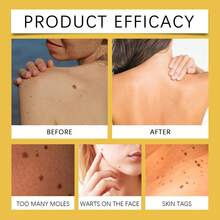 Skin Care Cream - Blemishes Removal, Highly Moisturizing Anti-Wrinkle, Gentle Ingredients For Body And Face Care - Yellow - View 2