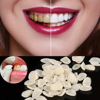 50 piezas Kit temporal de reemplazo dental, carillas adhesivas para blanqueamiento de dientes, simple y conveniente, adecuado para diversas formas de dientes, aumenta la confianza y el Charm de la sonrisa