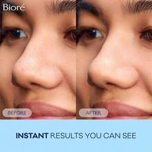 Biore Deep Cleansing Pore Strips, Original, Blackhead Remover Strips, Oil Free, Pore Unclogging - 8ct - 1 - View 4