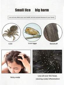 1 件专业超细齿双面虱子梳 - 优质大理石纹塑料虱子梳，用于深层清洁头皮、去除头皮屑和头虱/跳蚤，0.2 毫米超密齿，符合人体工程学的手柄（适合敏感头皮和浓密头发护理） - 彩色 - 查看 4