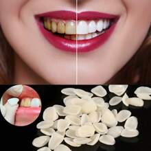 50pcs Temporary Tooth Replacement Kit, Teeth Whitening Veneers, Simple And Convenient, Fit Various Tooth Shapes, Boost Confidence And Smile Charm
