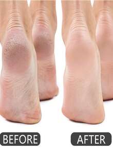 5 块足部浮石，有效火山石足部护理，混合 5 种颜色 PU 材质磨砂膏和专业去角质石，用于足部手部身体护理 - 足部硬皮老茧去除剂，足部护理，老茧去除剂修脚，足部磨砂膏