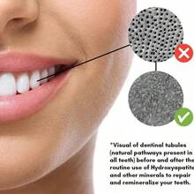 OFFICIAL Nathan & Sons UNDERBRUSH Remineralizing Chewing Gum With-Hydroxyapatite Teeth And Gum - 30 DAY SUPPLY - 肉桂乳香 - 查看 5