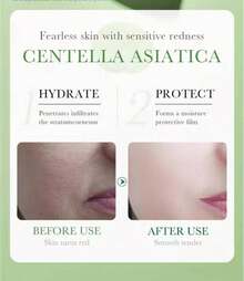 BIOAQUA Centella Asiatica TÓNICO facial calmante reparador nutritivo  control de aceite,piel hidratante, piel seca y sensible,120ml - verdes - Ver 6