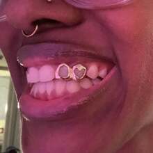 THATBOY 1件/2件/4件/套 镂空心形牙套，18K镀金，女士日常佩戴牙饰 - 彩色 - 查看 7