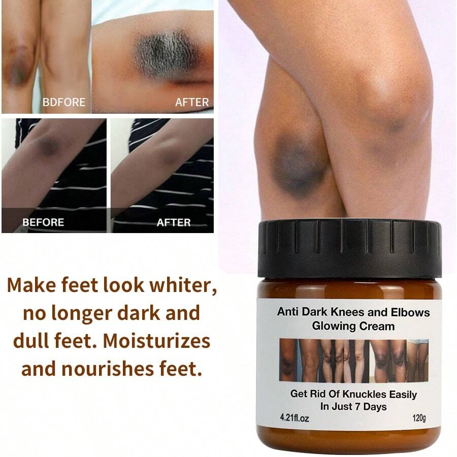 FATAZEN 天然極致身體乳霜，含有維生素C保濕修護膚膏，適用於膝蓋、手肘皺紋和臉部身體護膚