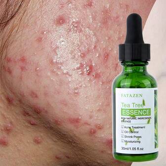 FATAZEN 30毫升有機茶樹精華，用於面部護理，草本面部精華，美白淡斑，平滑乾燥和敏感肌膚，適用於抗衰老皺紋，祛痘，潤澤保濕，控油抗氧化