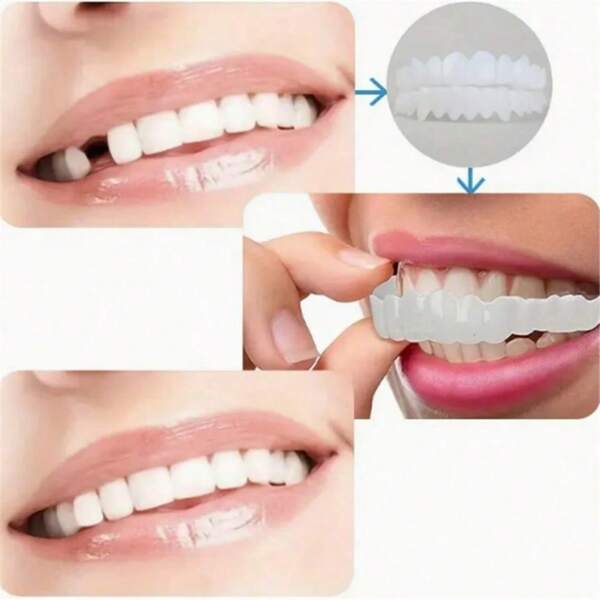 4pcs Smile Teeth Whitening Decoration Kit, 2nd Gen, Easy To Use