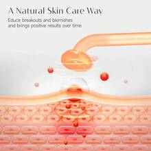 Máquina De Terapia Facial De Alta Frecuencia Herramientas Para El Cuidado De La Piel Con 4 Accesorios - Tipo de Enchufe A USA (110-127V) - Ver 3