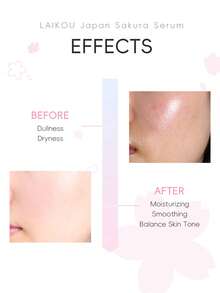 2件装 LAIKOU 日本樱花深层滋养面部精华液和面霜，肌肤焕活精华液收缩毛孔面部护理提亮肤色保湿霜，旅行装，护肤SPA礼品，送给女性、妈妈、妻子、姐妹、青少年、女友，母亲节化妆品 - Serum & Cream - 查看 6