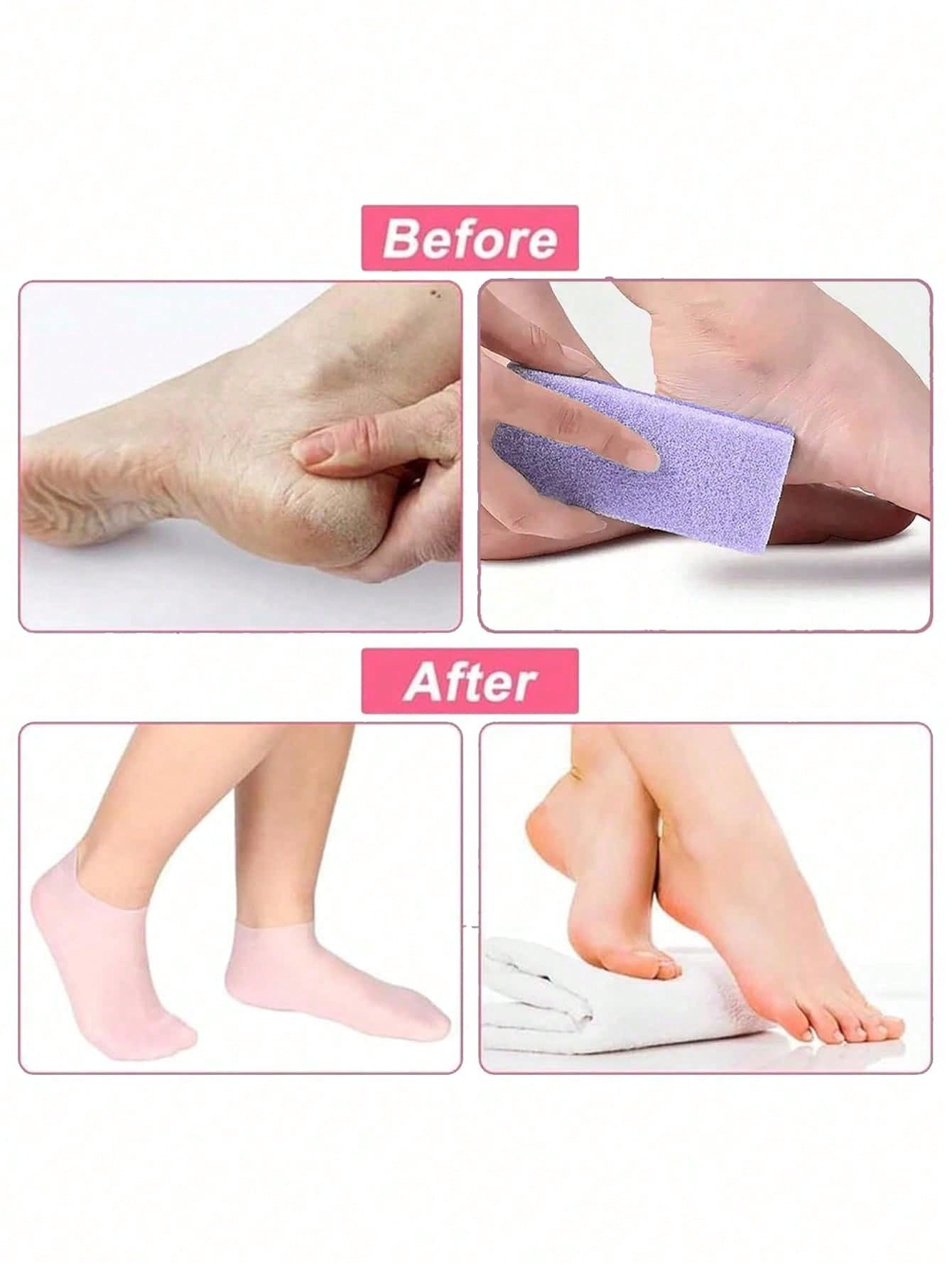 زوج من جوارب السيليكون المرطبة والمخففة للألم للعن...