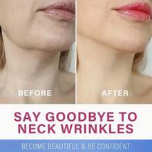 10 条可重复使用的透明颈部提拉条 PU 材质，用于颈部护理中的紧张皮肤，改善皱纹和松弛皮肤，无需电力或电池，颈部提拉条