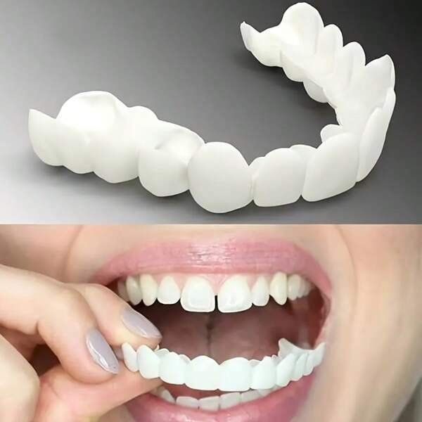 Prothèse dentaire supérieure et inférieure blanche naturelle confortable avec boîte de rangement - Sourire parfait, facile à installer, convient à toutes les formes de dents