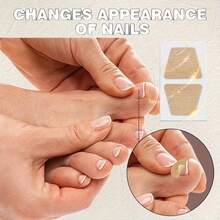 32/72pcs Toenail Care Tape, Thick Nail Protection, Double-Layer Design Of Adhesive Tape Nail Protection And Appearance - Apricot - View 6